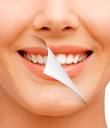 5 ingredientes naturales que blanquearán tus dientes