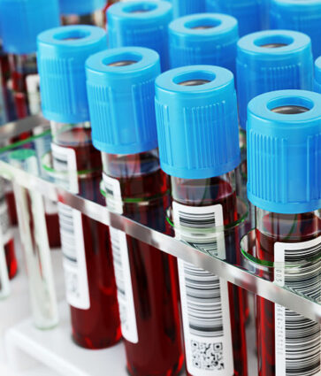Nuevo análisis sanguíneo podría detectar cáncer 10 años antes