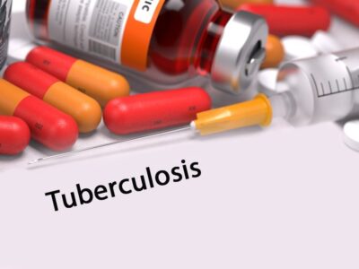 Aprueban nuevo antibiótico contra la tuberculosis