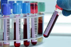 Análisis de sangre detecta hasta 20 tipos de cáncer