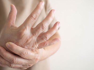 Las mujeres más propensas a la artritis reumatoide