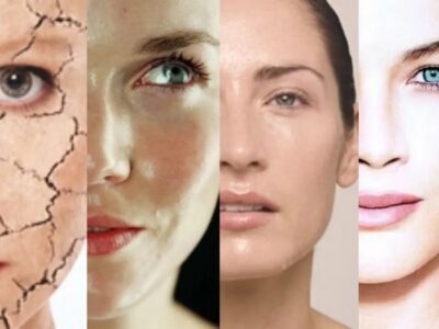 Los diferentes tipos de piel: cómo identificarlos y tips para saber como cuidarlos