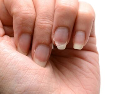 Cómo rescatar las uñas frágiles con los mejores tratamientos