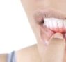5 condiciones de salud relacionadas con enfermedad de las encías