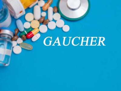 Enfermedad de Gaucher, ¿qué es y cuáles son sus tipos?