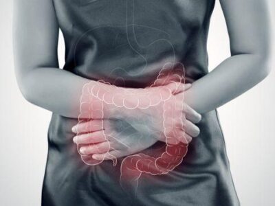 Enfermedad inflamatoria intestinal y síndrome de colon irritable. ¿Son lo mismo?