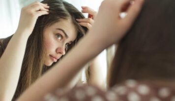 ¿Puede la caspa causar la caída del cabello?