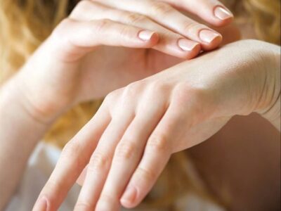 El Emite SESA recomendaciones para el cuidado de la piel en temporada invernal