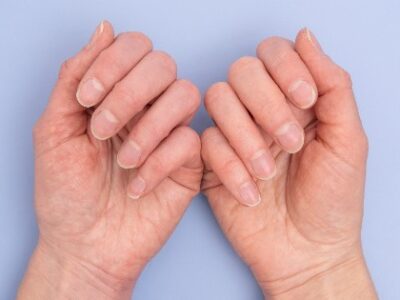 5 cambios en las uñas que no debes ignorar