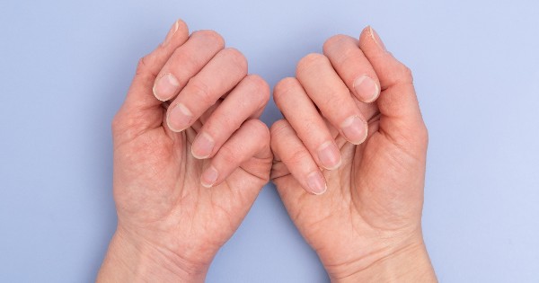 5 cambios en las uñas que no debes ignorar